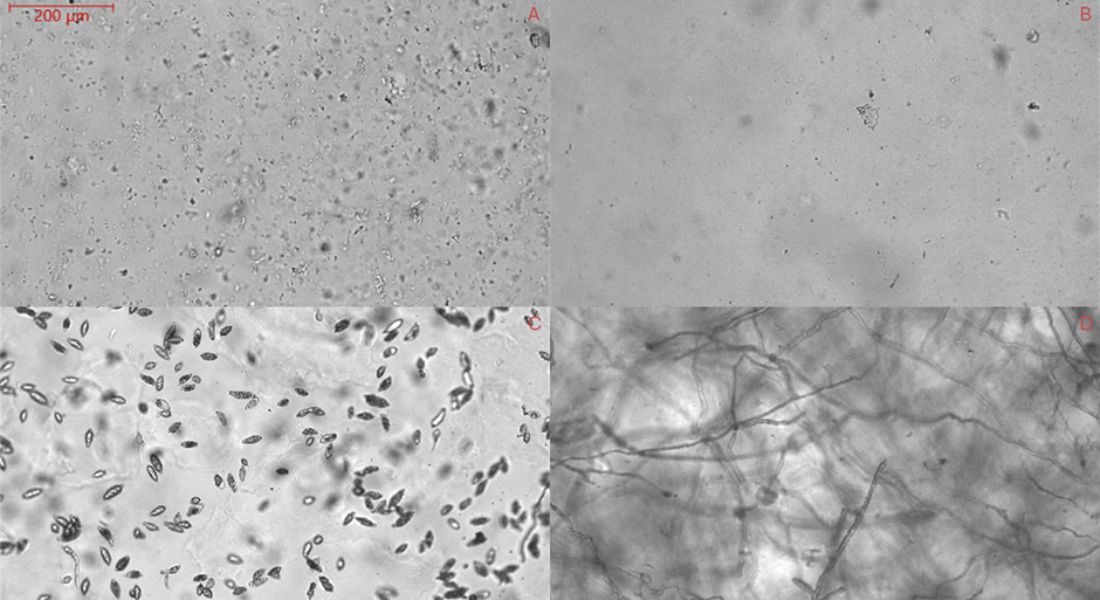 Microscopic observations on an oCelloscope of Phytophthora infestans 
