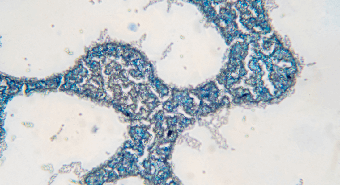 Saccharomyces cerevisia